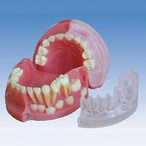 Three years old children milk teeth and permanent teeth alternate model